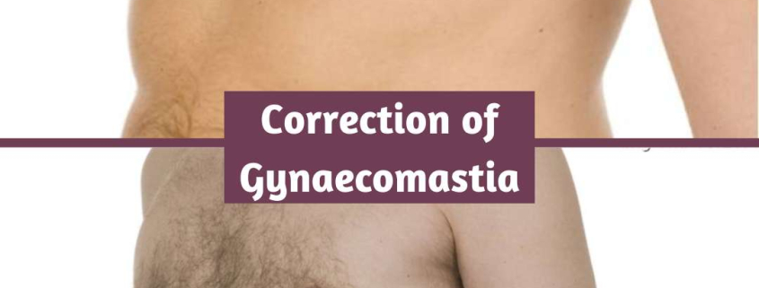 Gynaecomastia Correction