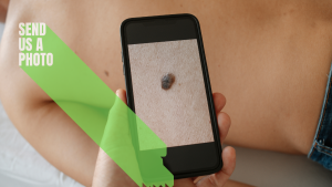 instant mole check clinic