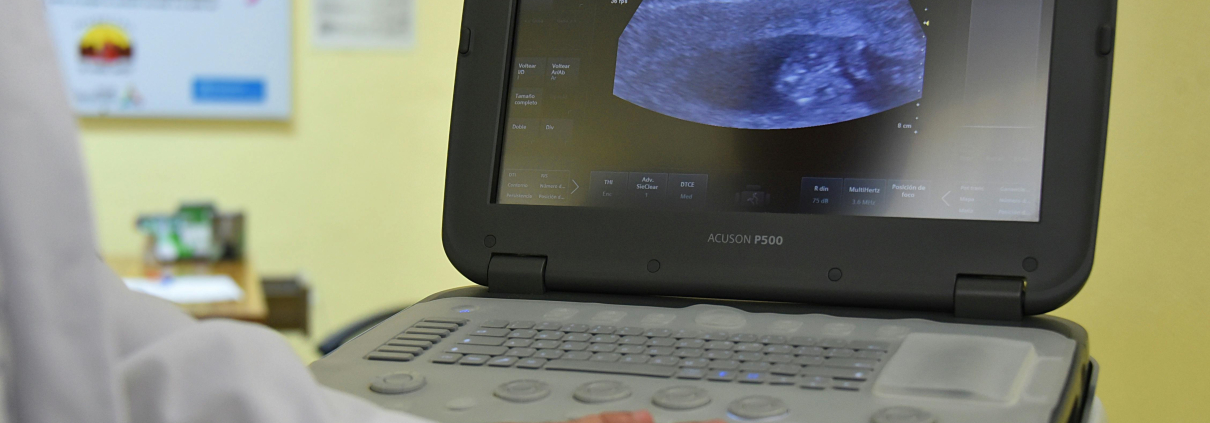 lipoma scan image