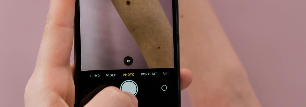 take a photo of your mole