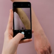 take a photo of your mole