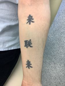 surgical tattoo removal on arm 2 years before